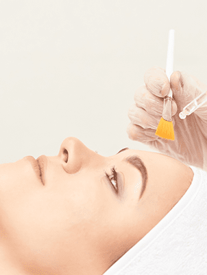 Chemical Skin Peels