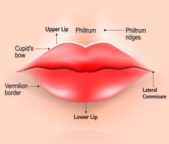 Dermal Lip Filler